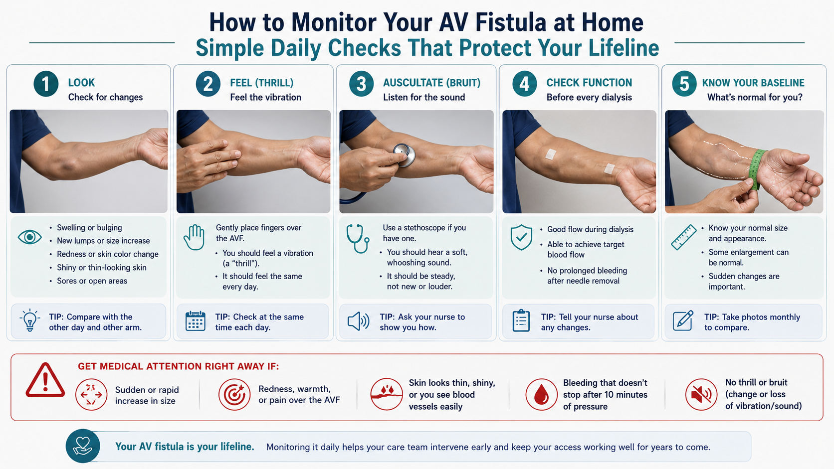 LOOK-FEEL-LISTEN home monitoring method for daily AVF assessment — patient education poster — by W Rivero, MD