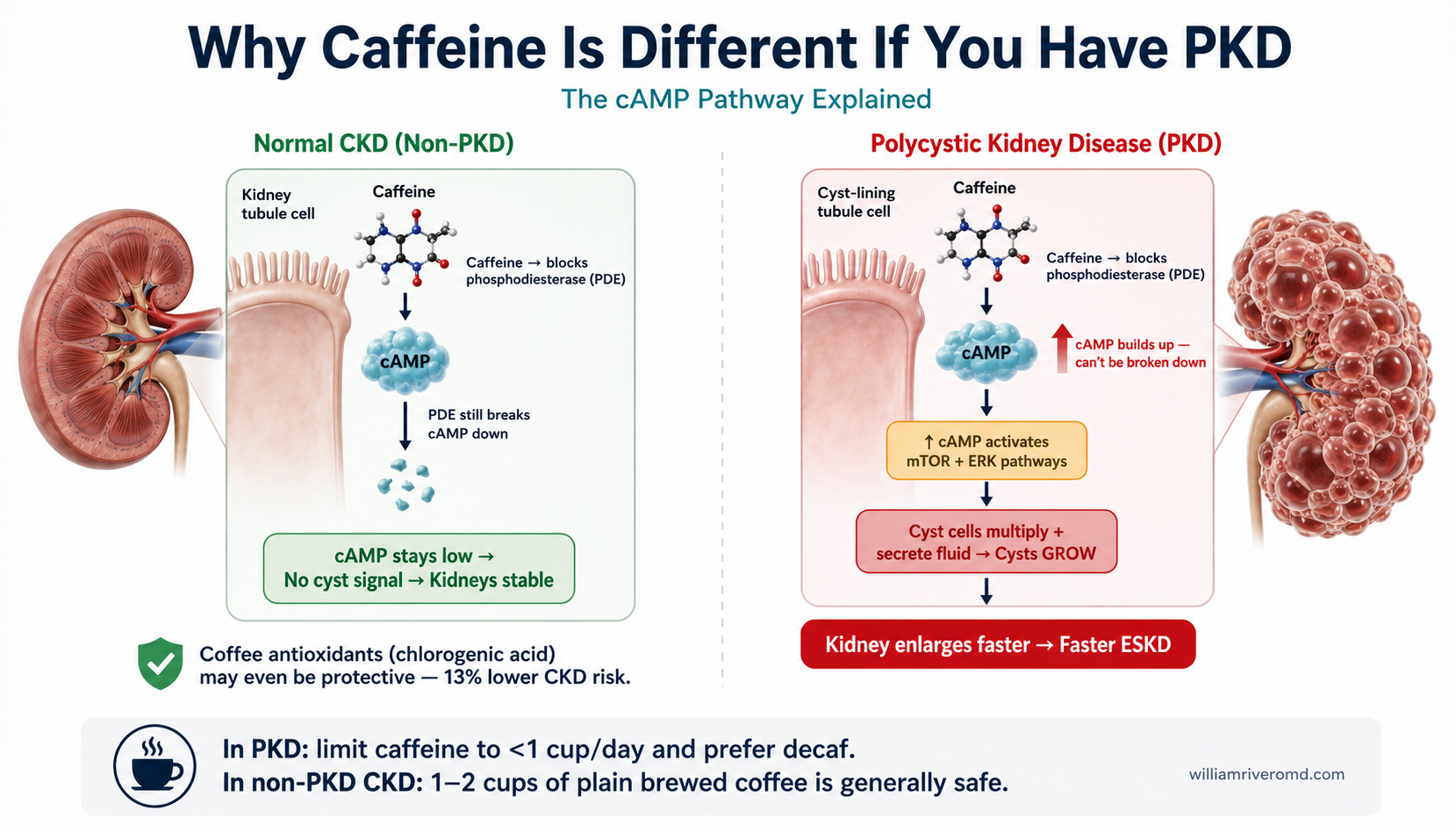 How caffeine raises cyclic AMP (cAMP) in polycystic kidney disease, accelerating cyst fluid secretion and growth.