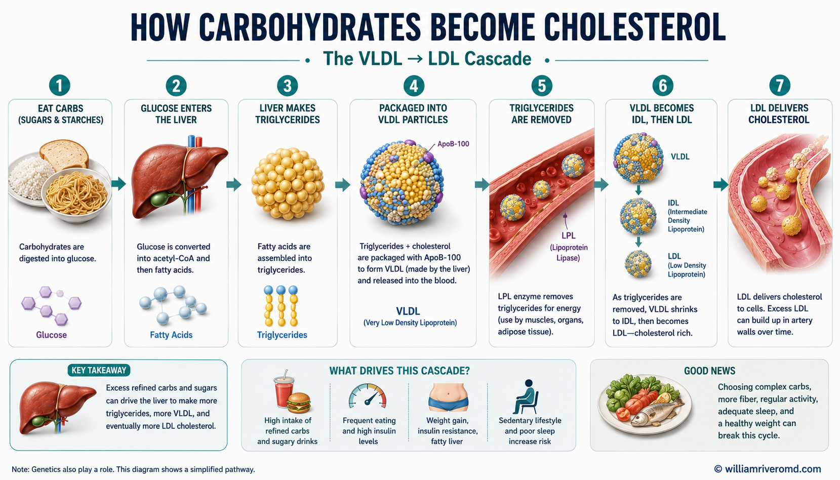 How excess carbohydrates raise cholesterol: glucose to acetyl-CoA, de novo lipogenesis, VLDL assembly, and the VLDL to IDL to LDL cascade, plus the fructose fast lane and TG/HDL ratio.