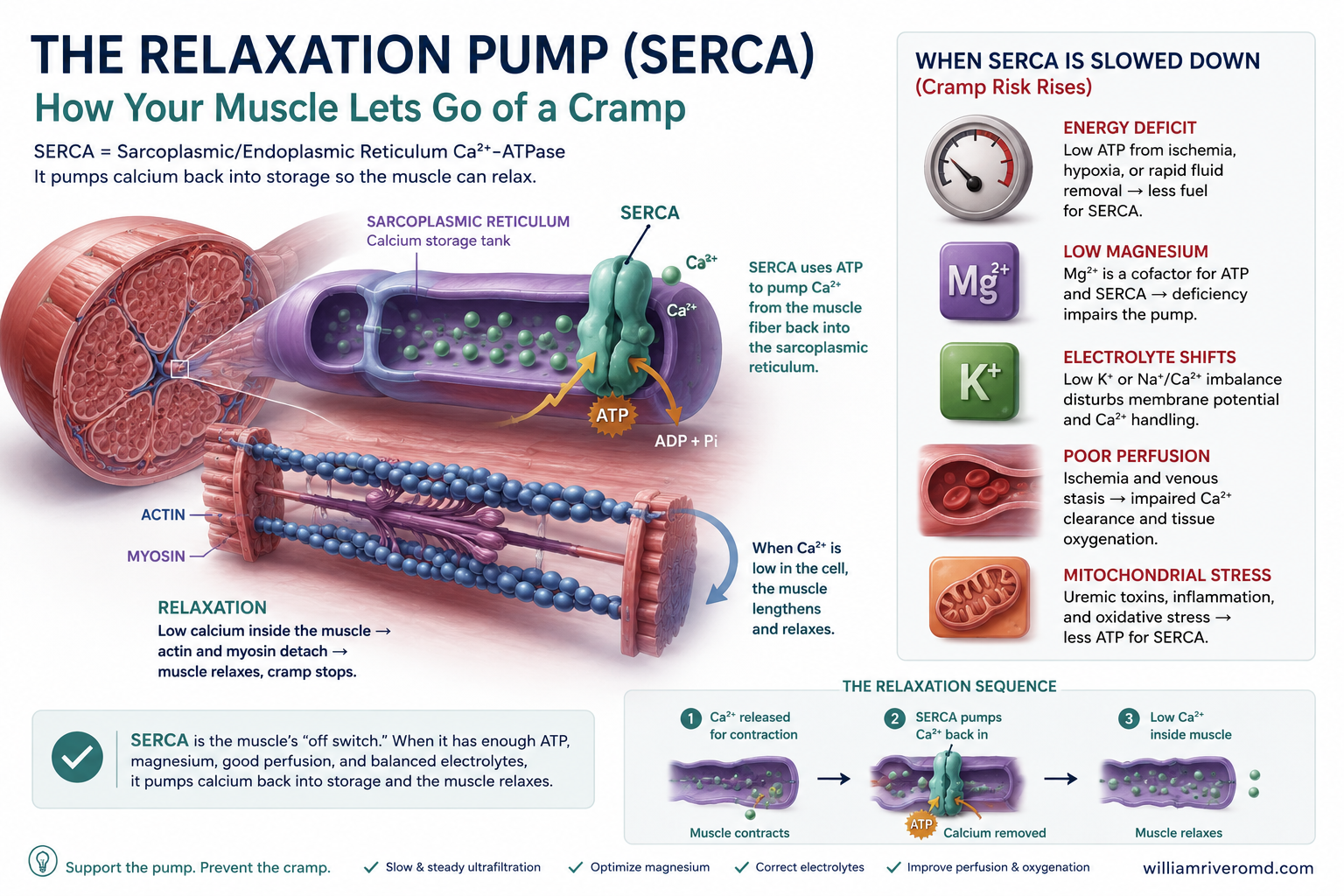 Multi-scale schematic of the SERCA Ca²⁺ ATPase pump on the sarcoplasmic reticulum, showing how falling ATP supply during ultrafiltration causes failure of muscle relaxation.