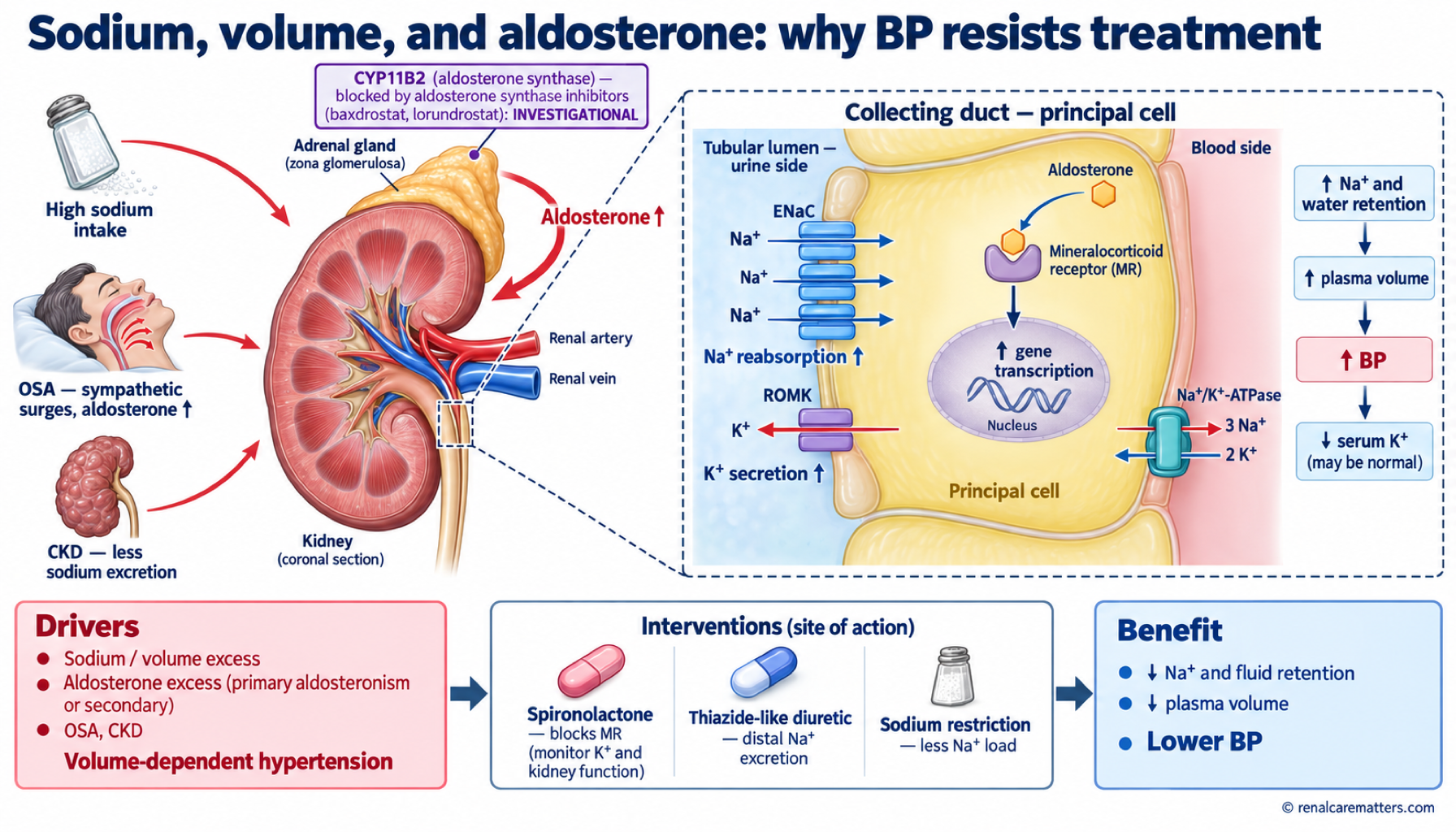 Mechanism schematic of aldosterone and sodium retention in the collecting duct driving resistant hypertension, with sites of drug action.