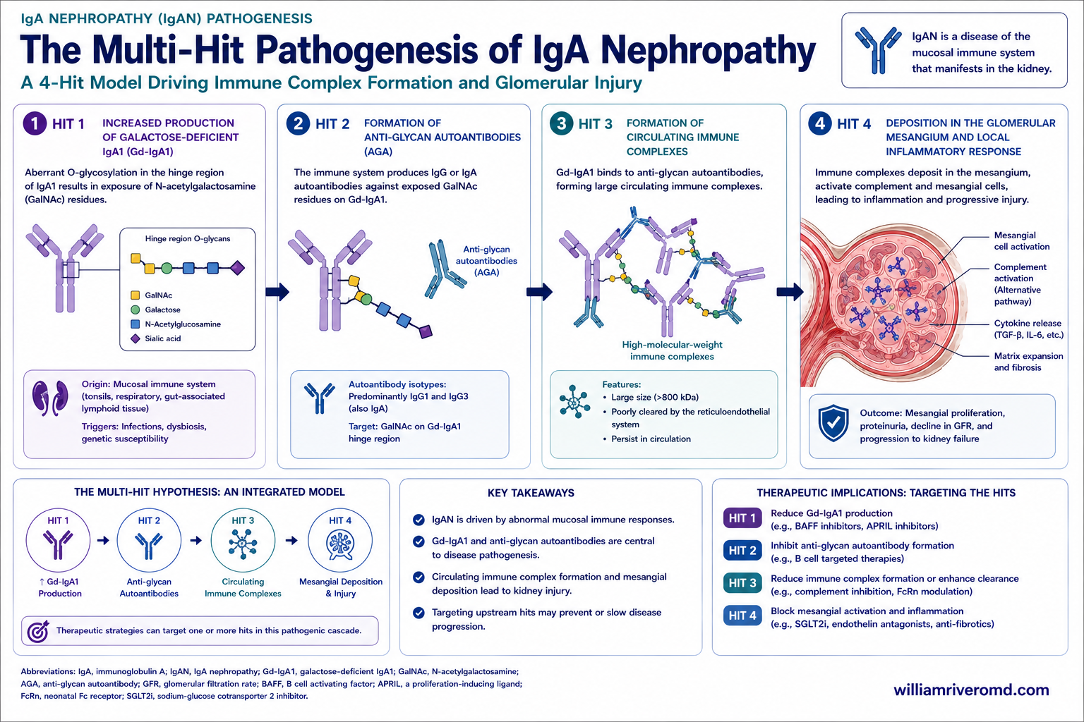 IgA Nephropathy pathophysiology — the 4-hit model: aberrant IgA1 production, autoantibody formation, immune complex deposition, glomerular injury