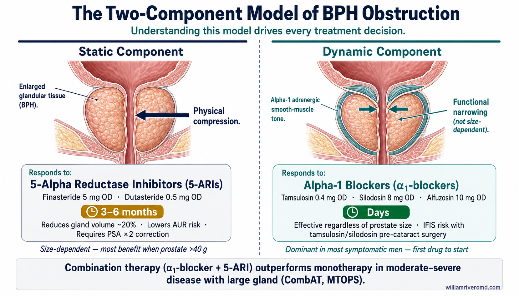 BPH two-component obstruction model — static component (gland bulk, 5-ARI target) vs dynamic component (alpha-1 smooth-muscle tone, alpha-blocker target)