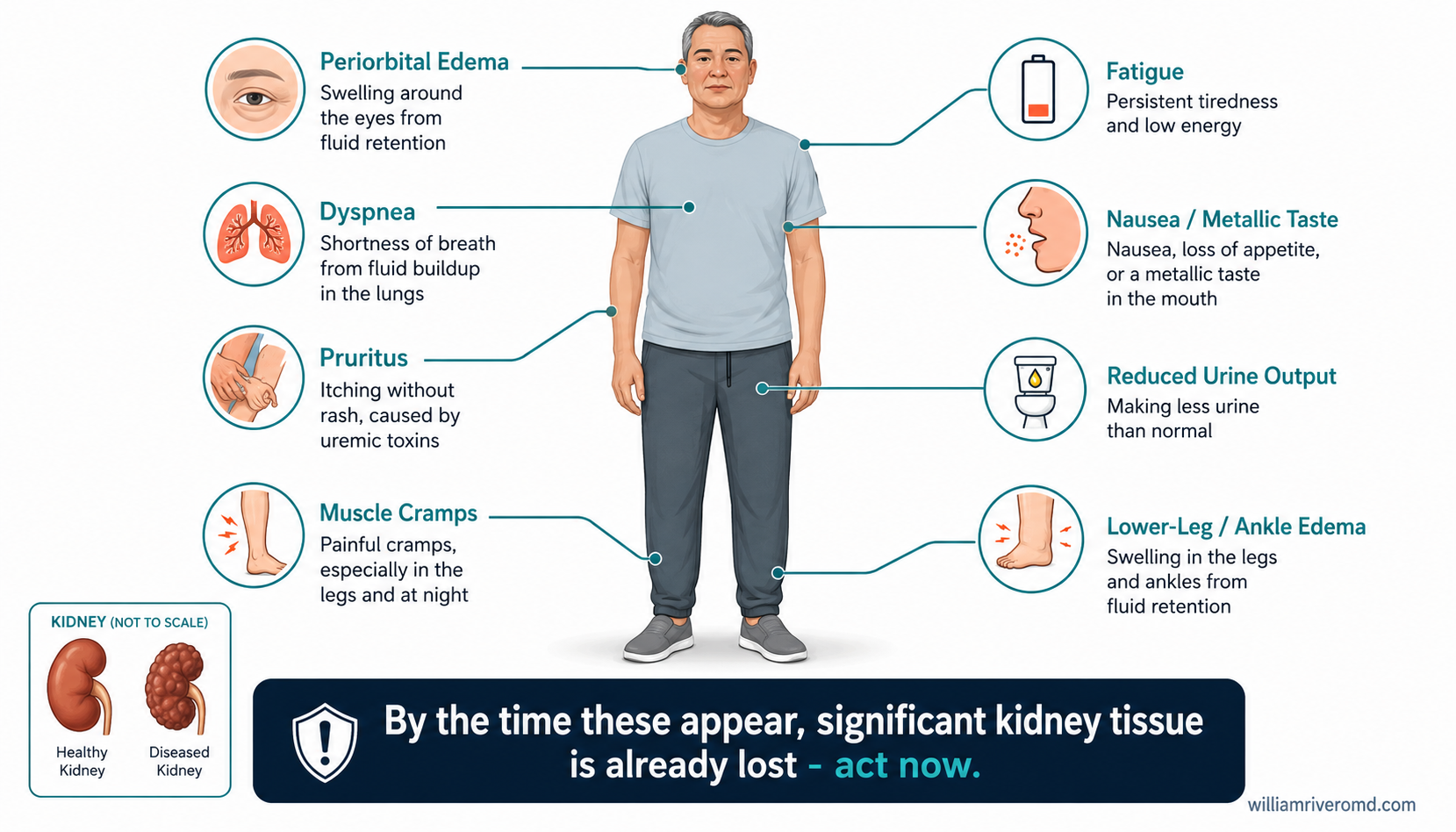 A standing figure with labeled leader lines pointing to swelling around the eyes and lower legs, shortness of breath, itchy skin, fatigue, nausea, muscle cramps, and reduced urine output, with a small not-to-scale kidney inset
