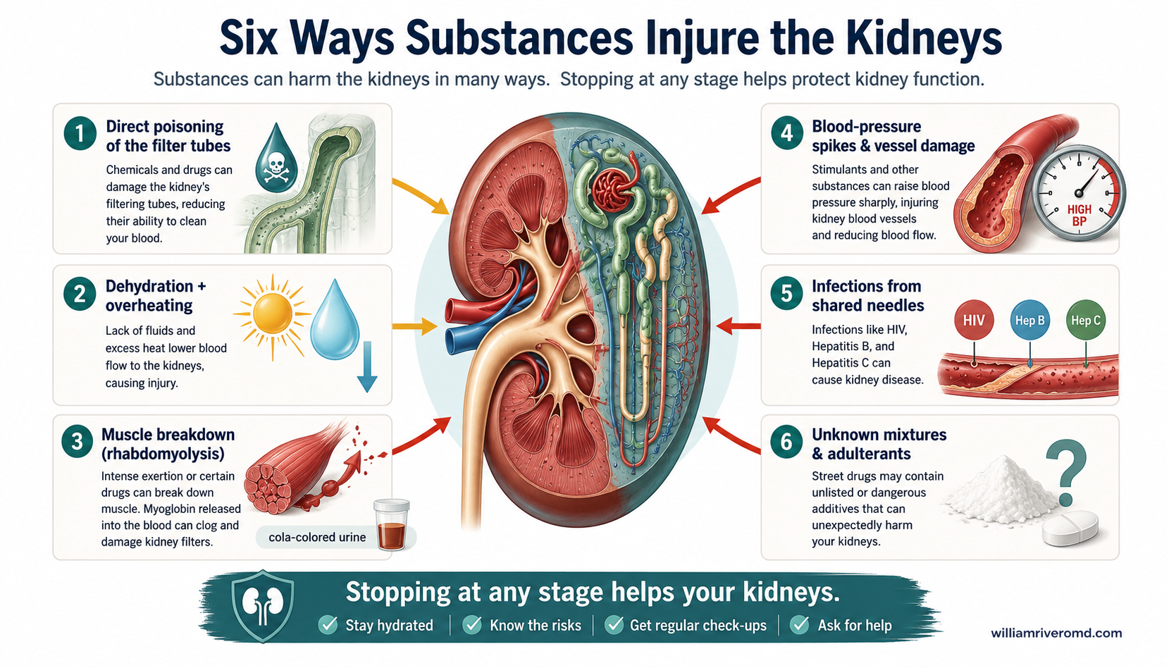 Infographic: six ways substances injure the kidneys.